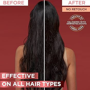 L'Oréal elvive shampoo fortalecedor 360ml - شامبو الشعر التالف والجاف من لوريال باريس